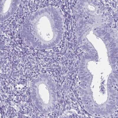 Immunohistochemistry-Paraffin: SCP1 Antibody [NBP2-54674]
