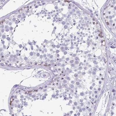 Immunohistochemistry-Paraffin: SCP1 Antibody [NBP2-54674]