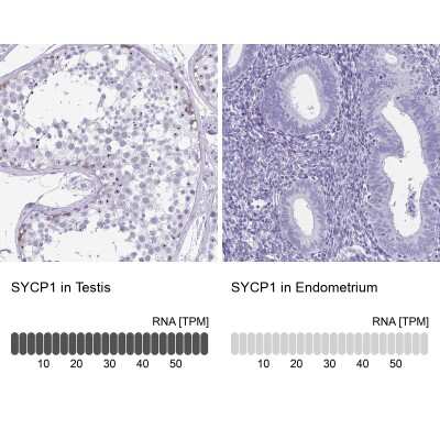 Immunohistochemistry-Paraffin: SCP1 Antibody [NBP2-54674]