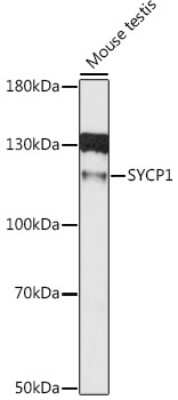 Western Blot: SCP1 AntibodyAzide and BSA Free [NBP2-95256]