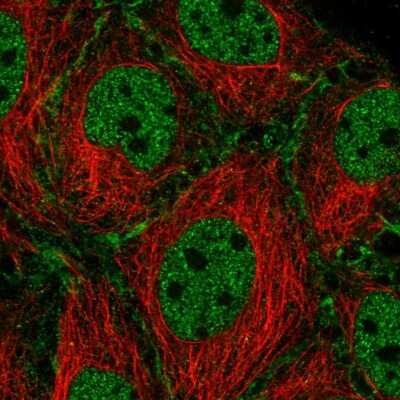 Immunocytochemistry/ Immunofluorescence: SCP2/SYCP2 Antibody [NBP2-55940]