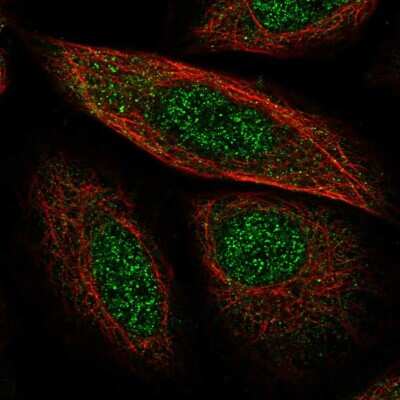 Immunocytochemistry/ Immunofluorescence: SCP2/SYCP2 Antibody [NBP2-56608]