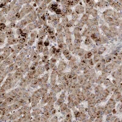 Immunohistochemistry-Paraffin: Sterol carrier protein 2 Antibody [NBP1-86402]