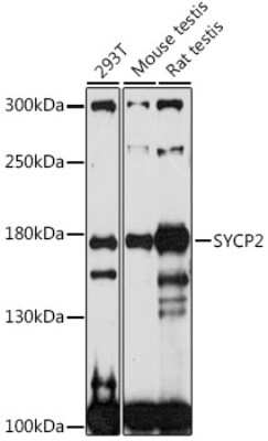 Western Blot: SCP2/SYCP2 AntibodyAzide and BSA Free [NBP2-94045]