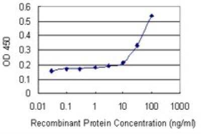 ELISA: SCP2D1 Antibody (3C11) [H00140856-M01]