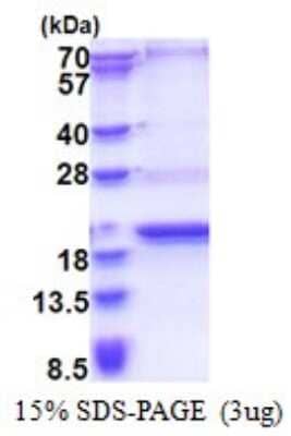 SDS-PAGE: Recombinant Human SCP2D1 His Protein [NBP2-51634]