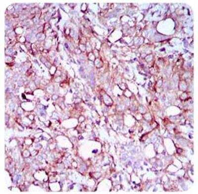 Immunohistochemistry: SCP3/SYCP3 Antibody (6F9C5) [NBP2-23487]