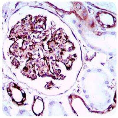 Immunohistochemistry: SCP3/SYCP3 Antibody (6F9C5) [NBP2-23487]