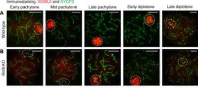 Immunocytochemistry/ Immunofluorescence: SCP3/SYCP3 Antibody [NB300-231]