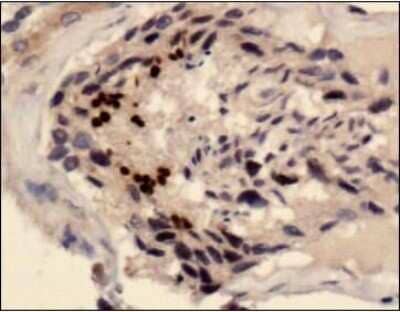 Immunohistochemistry-Paraffin: SCP3/SYCP3 Antibody - BSA Free [NB300-232]