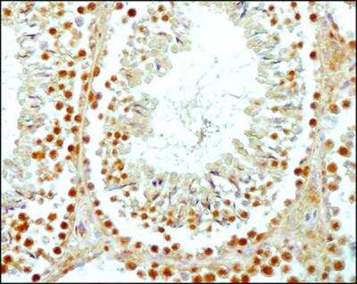 Immunohistochemistry-Paraffin: SCP3/SYCP3 Antibody - BSA Free [NB300-232]