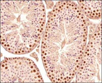 Immunohistochemistry-Paraffin: SCP3/SYCP3 Antibody - BSA Free [NB300-232]