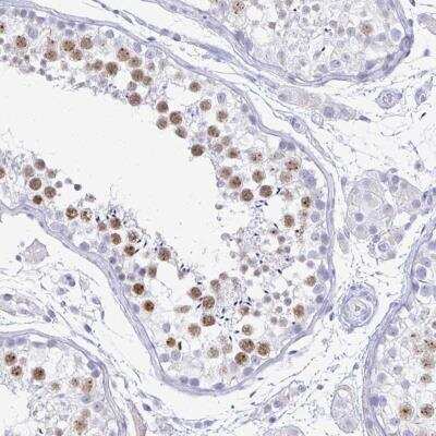 Immunohistochemistry-Paraffin: SCP3/SYCP3 Antibody [NBP2-48713]
