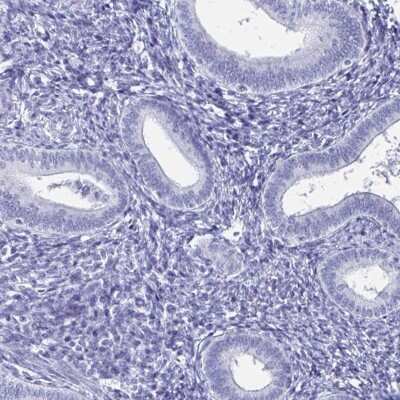 Immunohistochemistry-Paraffin: SCP3/SYCP3 Antibody [NBP2-48713]