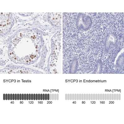 Immunohistochemistry-Paraffin: SCP3/SYCP3 Antibody [NBP2-48713]
