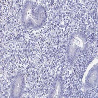 Immunohistochemistry-Paraffin: SCP3/SYCP3 Antibody [NBP2-48713]
