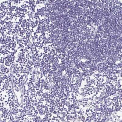 Immunohistochemistry-Paraffin: SCP3/SYCP3 Antibody [NBP2-48713]