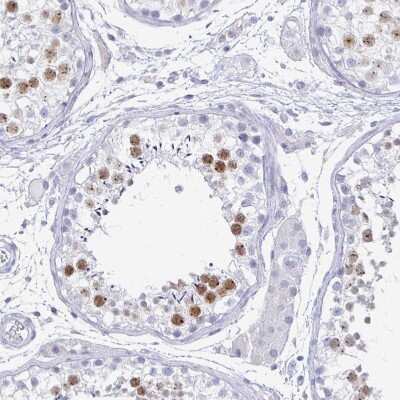 Immunohistochemistry-Paraffin: SCP3/SYCP3 Antibody [NBP2-48713]