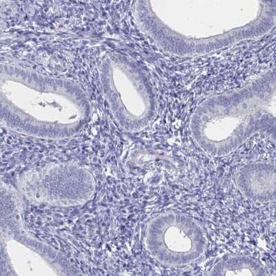 Immunohistochemistry-Paraffin: SCP3/SYCP3 Antibody [NBP2-54713]