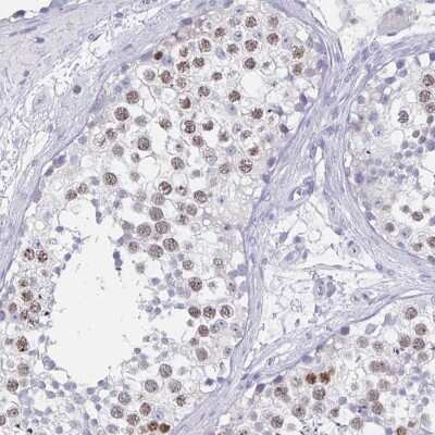 Immunohistochemistry-Paraffin: SCP3/SYCP3 Antibody [NBP2-54713]