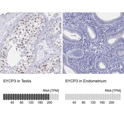 Immunohistochemistry-Paraffin: SCP3/SYCP3 Antibody [NBP2-54713]