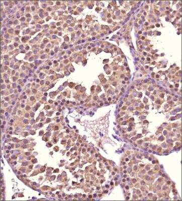Immunohistochemistry-Paraffin: SCP3/SYCP3 Antibody - BSA Free [NBP2-78133]