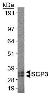 Western Blot: SCP3/SYCP3 AntibodyBSA Free [NB300-232]