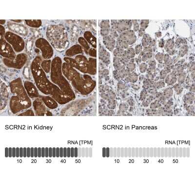 Immunohistochemistry-Paraffin: SCRN2 Antibody [NBP1-86419]