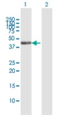 Western Blot: SCRN2 Antibody [H00090507-B01P]