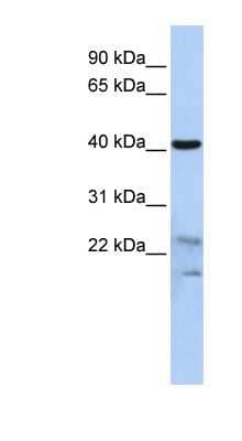 Western Blot: SCRN2 Antibody [NBP1-56896]