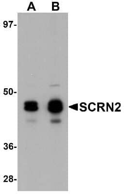 Western Blot: SCRN2 AntibodyBSA Free [NBP1-77188]