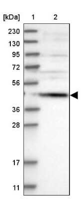 Western Blot: SCRN2 Antibody [NBP1-85994]