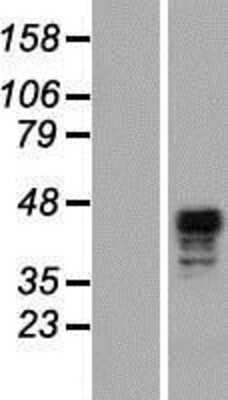 Western Blot: SCRN2 Overexpression Lysate [NBP2-05660]