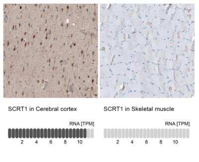 Immunohistochemistry-Paraffin: SCRT1 Antibody [NBP1-92369]