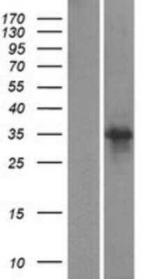 Western Blot: SCRT1 Overexpression Lysate [NBP2-06136]