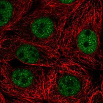 Immunocytochemistry/ Immunofluorescence: SCRT2 Antibody [NBP2-55969]