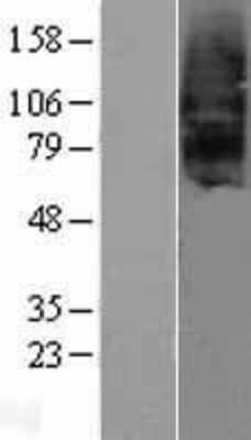 Western Blot: Secretin R Overexpression Lysate [NBP2-08052]