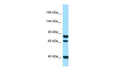 Western Blot: SCUBE1 Antibody [NBP2-85701]