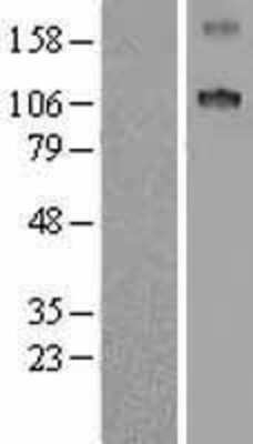 Western Blot: SCUBE1 Overexpression Lysate [NBL1-15754]