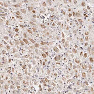 Immunohistochemistry-Paraffin: SCUBE2 Antibody [NBP1-85693]