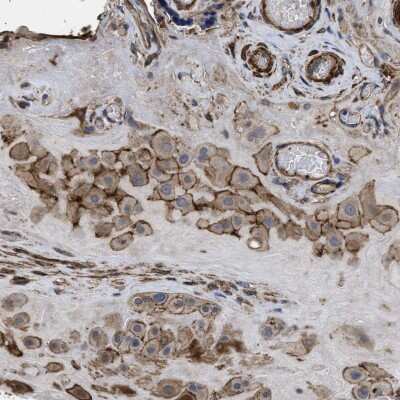 Immunohistochemistry-Paraffin: SCUBE2 Antibody [NBP1-85694]