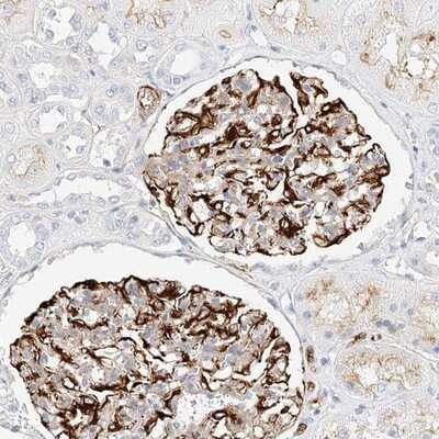 Immunohistochemistry-Paraffin: CDCP2 Antibody [NBP1-87438]