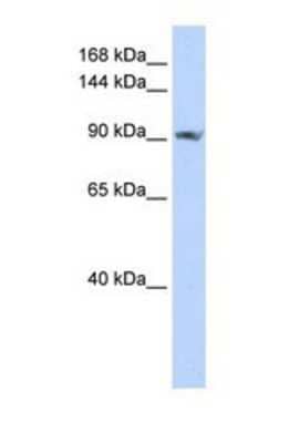 Western Blot: SCUBE2 Antibody [NBP1-69603]