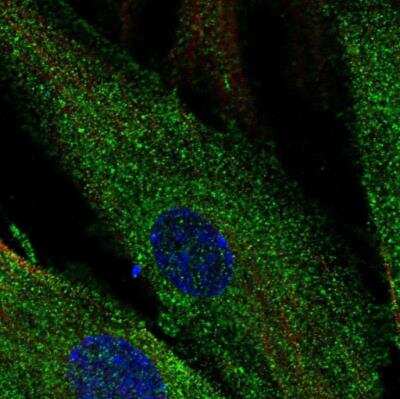 Immunocytochemistry/ Immunofluorescence: SCUBE3 Antibody [NBP1-85692]