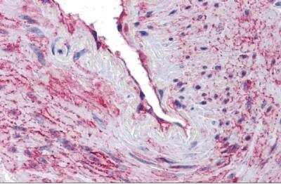 Immunohistochemistry-Paraffin: SCUBE3 Antibody - BSA Free [NBP2-41122]