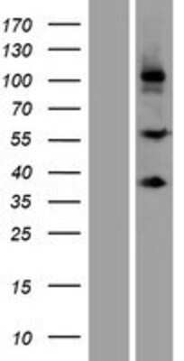 Western Blot: SCUBE3 Overexpression Lysate [NBP2-05314]