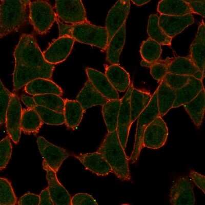 Immunocytochemistry/ Immunofluorescence: SCX Antibody (PCRP-SCXA-2D11) [NBP3-07598]