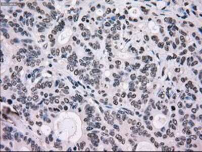 Immunohistochemistry-Paraffin: SCY1 like 3 Antibody (OTI1A5) [NBP1-47956]