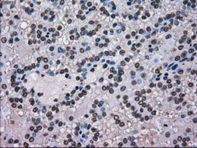 Immunohistochemistry-Paraffin: SCY1 like 3 Antibody (OTI1A5) [NBP1-47956]
