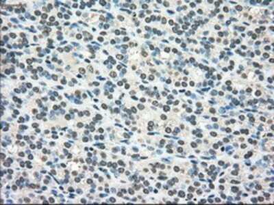 Immunohistochemistry-Paraffin: SCY1 like 3 Antibody (OTI1A5) [NBP1-47956]